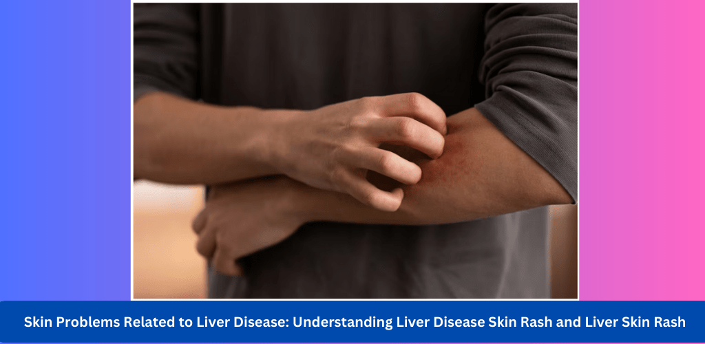 skin-problems-related-to-liver-disease