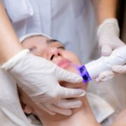 eczema light therapy