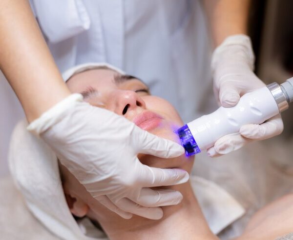 eczema light therapy