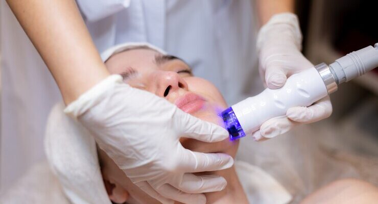 eczema light therapy