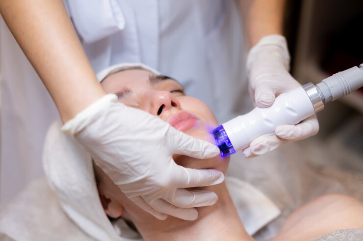 eczema light therapy